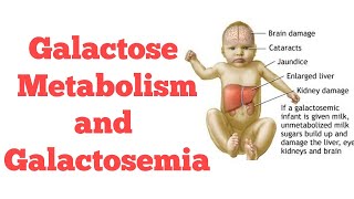 Galactose metabolism  Biochemistry [upl. by Atiral]