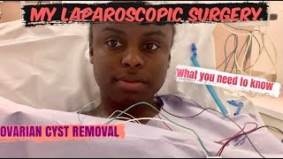 OVARIAN CYST LAPAROSCOPIC SURGERY  WHAT YOU NEED TO KNOW [upl. by Emmet]