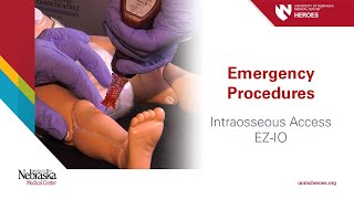 Emergency Procedures Intraosseous Access  EZIO [upl. by Niraj]