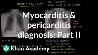 Diagnosis of myocarditis and pericarditis part 2  NCLEXRN  Khan Academy [upl. by Mcnamara]