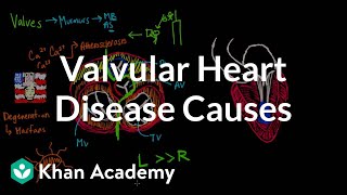 Tricuspid atresia  Circulatory System and Disease  NCLEXRN  Khan Academy [upl. by Ankeny]