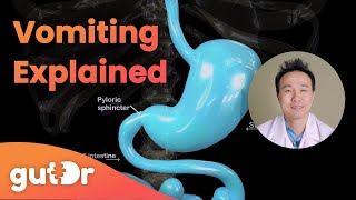 What Happens During Vomiting  The GutDr Explains 3D Gut Animation [upl. by Yeldoow]