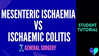 Mesenteric Ischaemia vs Ischaemic Colitis  Medical Tutorial [upl. by Antipus]