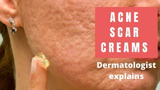 Acne Scar Creams  Dermatologist Reviews [upl. by Luht]