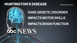 Living with Huntington’s disease [upl. by Luba]