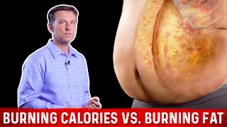 Burning Calories vs Burning FAT Calories – Dr Berg [upl. by Ahsemac]