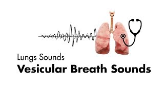 Vesicular Breath Sounds  Normal Lung Sounds  MEDZCOOL [upl. by Ojyllek]