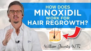 Minoxidil How Does Minoxidil Work For Hair Regrowth Results  Trichologist William Gaunitz [upl. by Ianteen535]