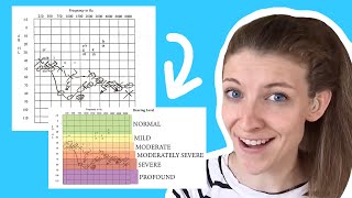 How to Read an Audiogram [upl. by Nance]