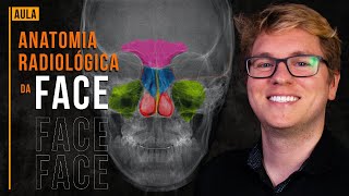 Anatomia Radiológica da Face [upl. by Eilla]