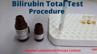 Bilirubin Test Procedure  Bilirubin Total Test [upl. by Asert]