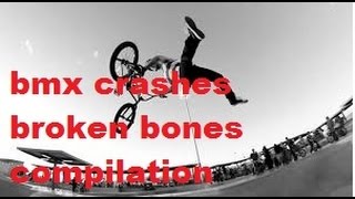 BMX crashes broken bones compilation [upl. by Aramac]