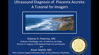 Prenatal Ultrasound Diagnosis of Placenta Accreta 2015 [upl. by Laina]