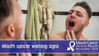 The Warning Signs of Mouth Cancer [upl. by Avelin]