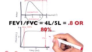 Understanding Spirometry  Normal Obstructive vs Restrictive [upl. by Anel379]