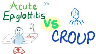 Acute Epiglottitis Vs Croup  A Detailed Comparison [upl. by Einnaej]