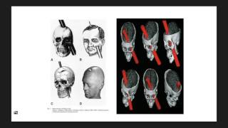 Neurociencia de la agresión y la violencia [upl. by Kellene]