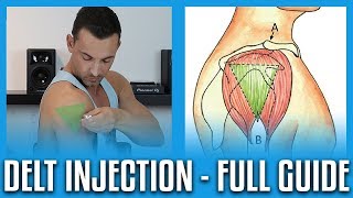 How To Do A Deltoid Injection  Full GuideDemo [upl. by Laux465]