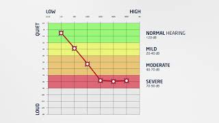 Hearcom  How to Read an Audiogram [upl. by Aenehs]