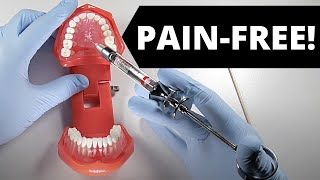 Deliver A Painless Palatal Injection  OnlineExodontiacom [upl. by Kalvin]