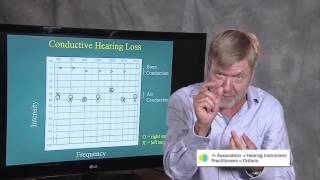 Ted Venema Talks Reading the Audiogram [upl. by Eirrej]