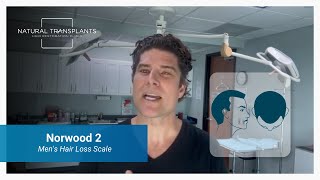 Norwood 2 Male Pattern Baldness Men’s Hair Loss Scale Explained [upl. by Nawud]