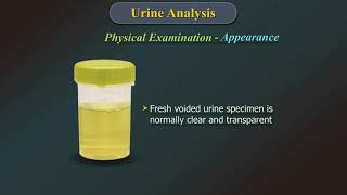 Urine Analysis [upl. by Beatriz]