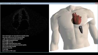 How to get the standard transthoracic echocardiography TTE views [upl. by Aivartal816]