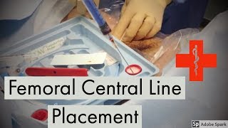 Femoral Central Line Placement [upl. by Orit461]