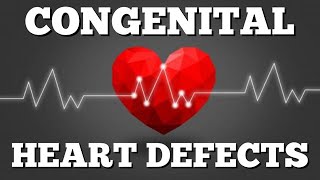 Chest Radiography in pediatric heart disease [upl. by Aerdnahc993]