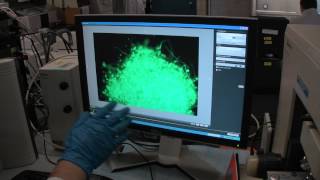 Borrelia Burgdorferi Biofilm  Live Microscopy Video [upl. by Althea]