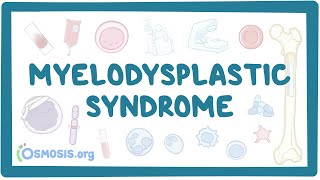 Pronounce Medical Words ― Myelodysplastic Syndrome [upl. by Nace]