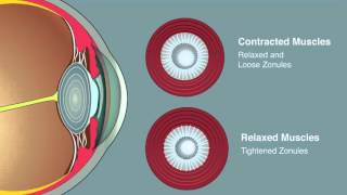 Lens Accommodation [upl. by Licht111]