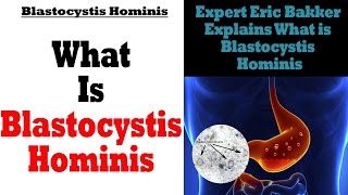 What Is Blastocystis Hominis  Ask Eric Bakker [upl. by Ssilb645]