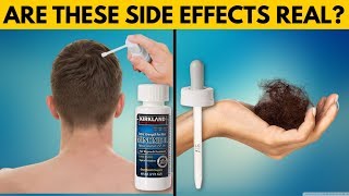 REAL TRUTH About Minoxidil Side Effects [upl. by Norha482]