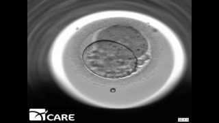 Time Lapse Embryo Imaging [upl. by Sanborn]