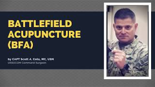 What You Need to Know about Battlefield Acupuncture BFA [upl. by Atirys]