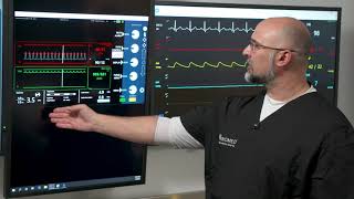 Understanding the SmartAssist AIC [upl. by Nashbar]