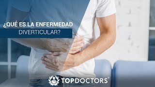 ¿Qué es la enfermedad diverticular [upl. by Auqinal884]