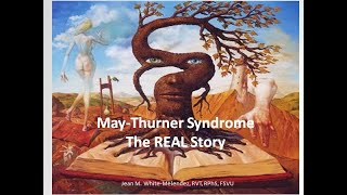 May Thurner  The REAL Story [upl. by Anaejer]