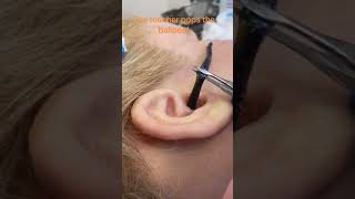 How to Remove worms inside the ear [upl. by Batista617]