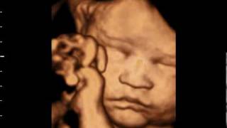 3D ultrasound at 31 weeks GoldenView Ultrasound [upl. by Eelessej273]