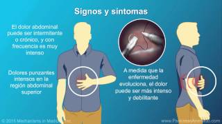 Pancreatitis crónica [upl. by Lynus]