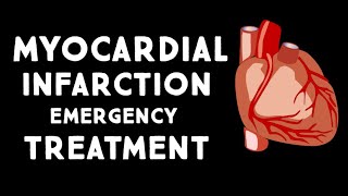 Myocardial Infarction MIHeart Attack Treatment in Emergency  Step wise STEMI Management USMLE [upl. by Placia]