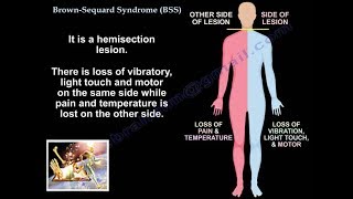 Edwards Syndrome and patau syndrome [upl. by Lesli453]