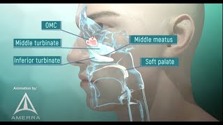 Why Do My Teeth Hurt With A Sinus Infection [upl. by Roux]