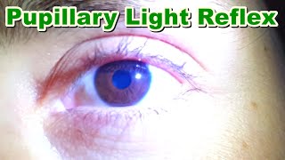 Pupillary Light Reflex  Contraction of Pupil MiosisMyosis  Function  Brain Stem [upl. by Anirdna852]