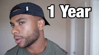 I Used Minoxidil For 1 Year  Heres What Happened [upl. by Dunkin]