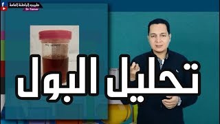 ازاى تقرا تحليل البول [upl. by Kasper]