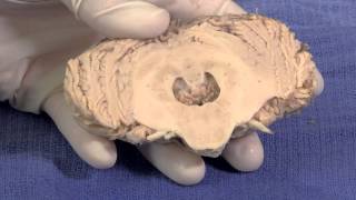 The Cerebellum Neuroanatomy Video Lab  Brain Dissections [upl. by Sevart]